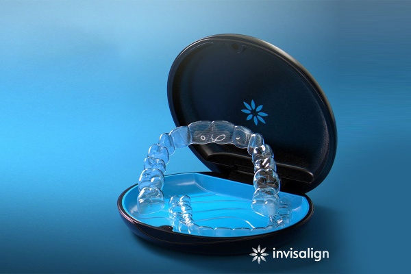 Quy trình niềng răng Invisalign diễn ra như thế nào?