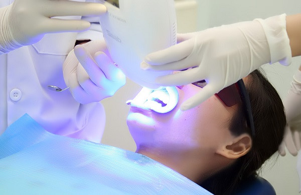 Tẩy trắng răng bằng phương pháp Laser Whitening tại nha khoa Happy