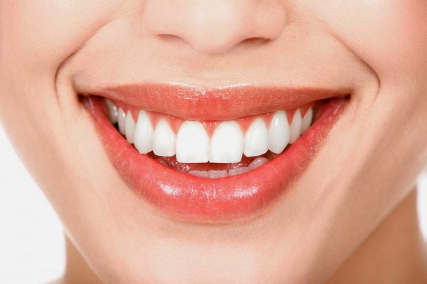 Cùng khám phá răng sứ có tẩy trắng được không?