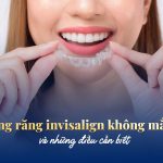 Niềng răng invisalign không mắc cài và những điều cần biết