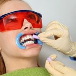 Nguyên nhân gây nhiễm màu răng?