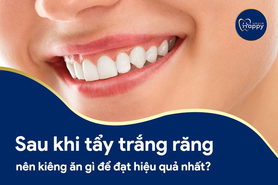 Sau khi tẩy trắng răng nên kiêng ăn gì để đạt hiệu quả nhất?