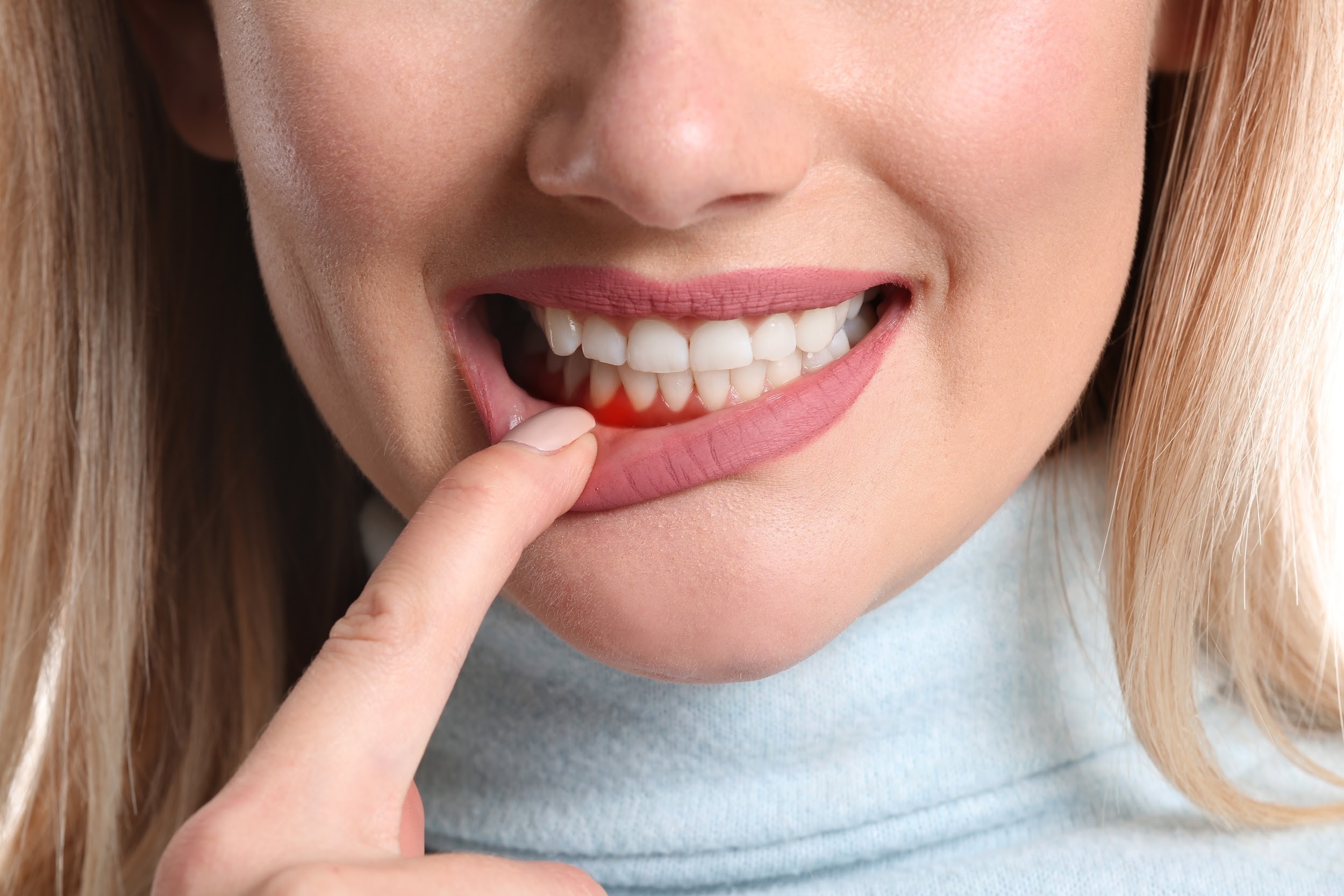 Viêm nha chu là bệnh nguy hiểm về răng miệng, có thể ảnh hưởng toàn bộ cấu trúc răng tác động nghiêm trọng đến sức khỏe răng miệng của người bệnh.