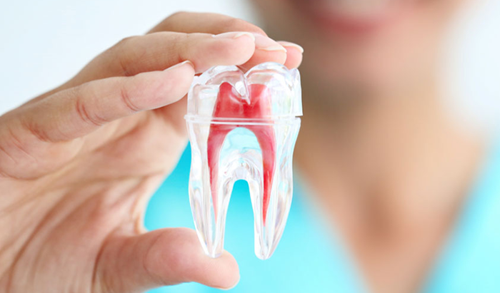 Quy trình chữa tuỷ răng và lưu ý sau khi chữa tuỷ răng