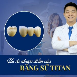Ưu và nhược điểm của răng sứ Titan