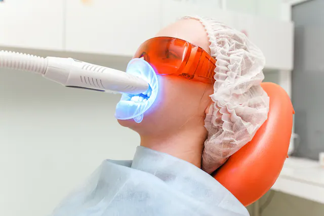 Tẩy trắng răng bằng laser là gì? Những lưu ý khi tẩy trắng