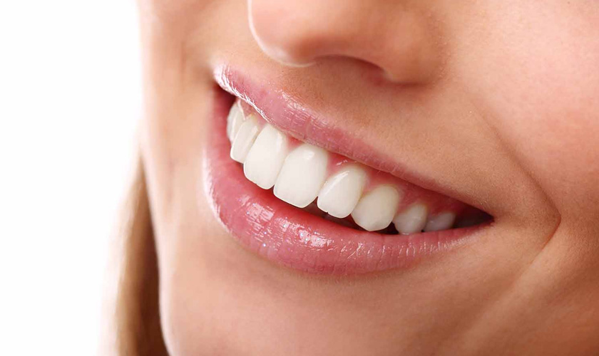 Bọc răng sứ giúp che các khuyết điểm