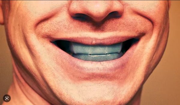 Những tác hại khi tẩy trắng răng không đúng cách 