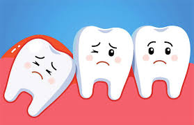 răng bị viêm tủy 