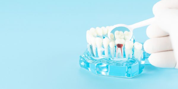 Viêm tủy răng có nguy hiểm không